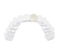 Ortho Aligner with Pontic Tooth