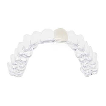 Ortho Aligner with Pontic Tooth